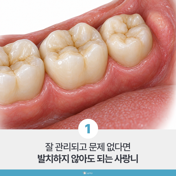 사랑니 발치 기준, 아프지 않아도 빼야 할까 이미지 2