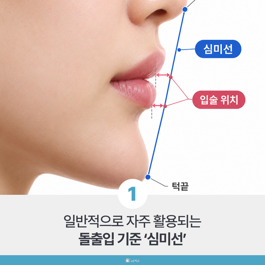 성인 돌출입 교정, 원인별로 어디까지 들어갈까 이미지 2