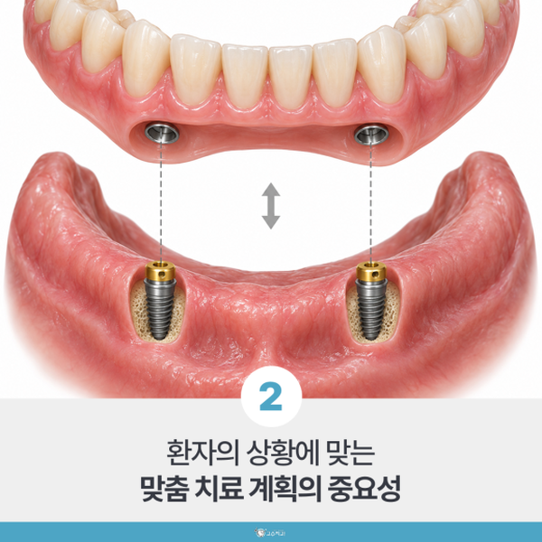 70대 80대 고령 임플란트, 나이보다 먼저 확인할 것 이미지 3