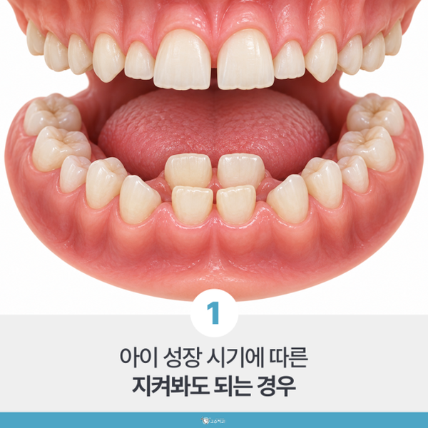 아이 부정교합 교정 시기, 지켜볼 때와 서두를 때 이미지 2