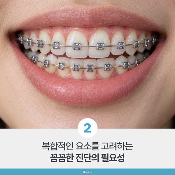 교정 잘하는 치과 고르는 3가지 기준 이미지 3