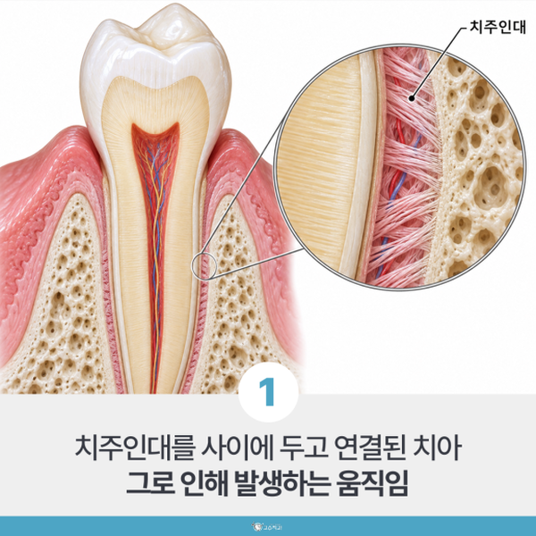 교정 중 치아 흔들림, 지켜봐도 되는 경우와 아닌 경우 이미지 2