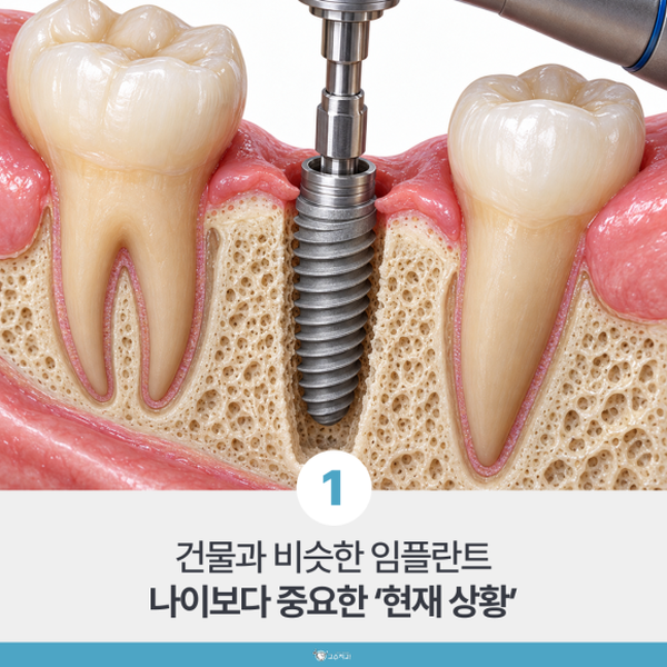 70대 80대 고령 임플란트, 나이보다 먼저 확인할 것 이미지 2
